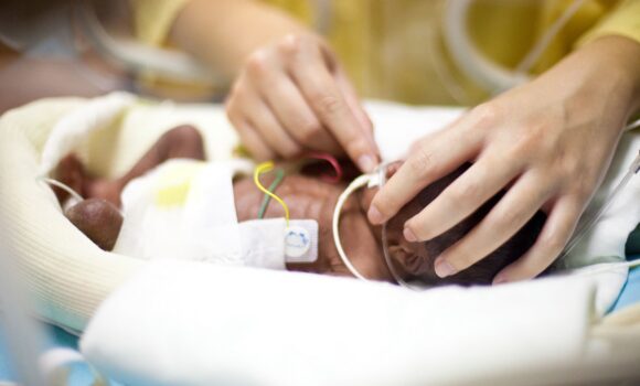 Photo d’illustration nouveau-née prématurée sous assistance respiratoire dans un service de néonatologie. Photo : Phanie Voisin via AFP
